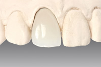 オールセラミッククラウン