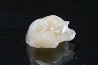 ハイブリッドインレー