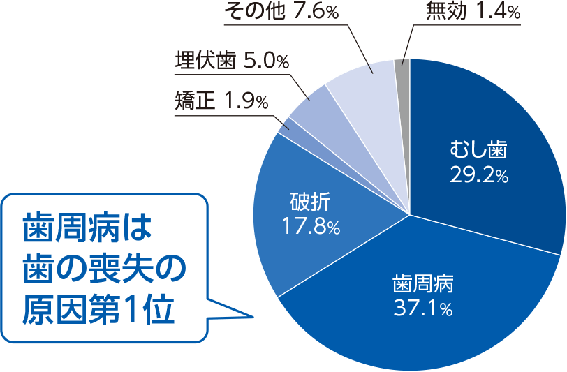 歯周病は歯の喪失の原因第1位