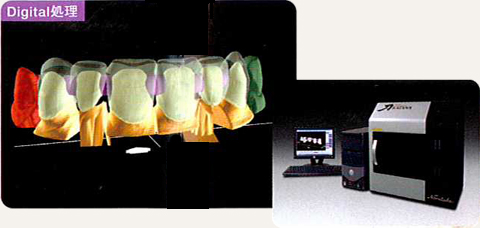 フレームスキャン