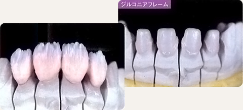 審美歯科 セラミック治療｜横浜市泉区のインプラント治療 青沼歯科